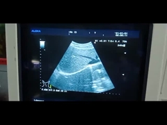 Aloka UST-9130 আল্ট্রাসাউন্ড প্রোব উত্তল অ্যারে UST-9130 আল্ট্রাসাউন্ড ট্রান্সডিউসার