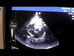 কার্ডিয়াক / পেডিয়াট্রিকের জন্য Mindray 2P2 ফেজড অ্যারে আল্ট্রাসাউন্ড ট্রান্সডুসার প্রোব