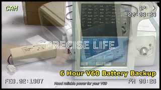 Respironics V60 ভেন্টিলেটর ব্যাটারি 6 ঘন্টা রানটাইম